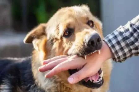 गुरुग्राम में बच्चे को पालतू कुत्ते ने काटा, मामला दर्ज गुरुग्राम में बच्चे को पालतू कुत्ते ने काटा, मामला दर्ज