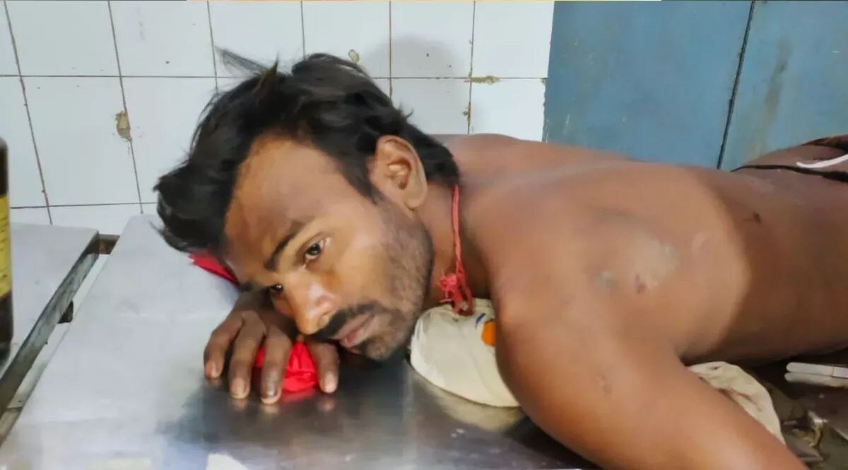 भाभी ने देवर को किया इग्नोर, गुस्से में बड़े भाई के प्राइवेट पार्ट को चाकू से गोदा बड़े भाई के प्राइवेट पार्ट पर किया हमला