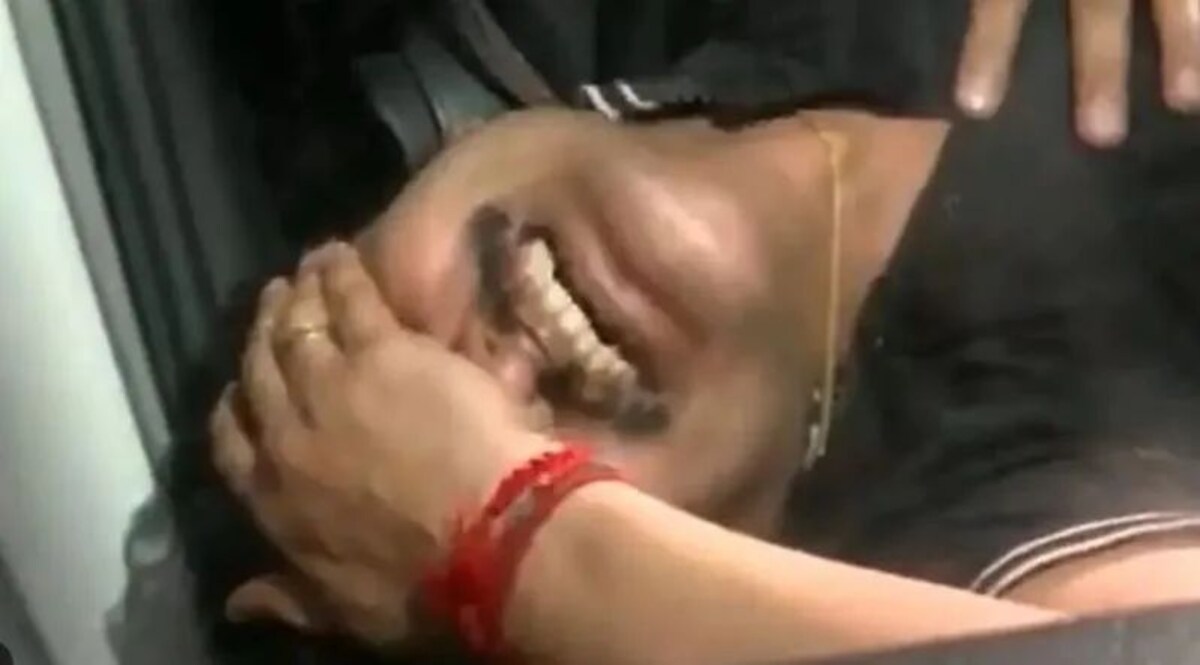 तमिलनाडु के मंत्री वी. सेंथिल बालाजी की हुई बाईपास सर्जरी, नौकरी के बदले कैश केस में आरोपी हैं सेंथिल वी. सेंथिल बालाजी