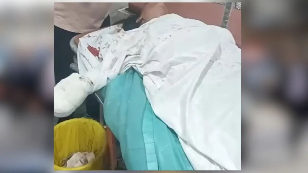 नोएडा सिटी सेंटर मेट्रो स्टेशन पर सुसाइड के इरादे से ट्रेन के चलते ही लड़की कूदी, हाथ कटा, जान बची