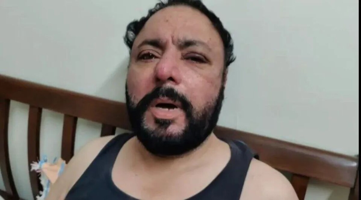 गुरुग्राम के पब बार में NRI युवक को गर्लफ्रेंड के सामने बाउंसरों ने खूब पीटा, बिना कुछ खाए पिए बिल भरने के दबाव का आरोप Gurugram Pub Bar Bouncers News