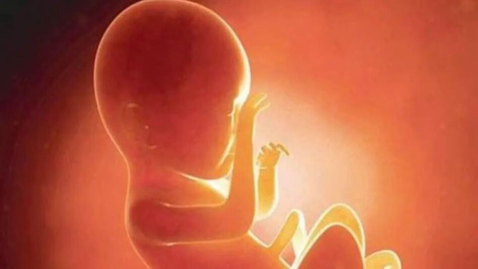 अदालत ने पति से अलग रही महिला को 23 सप्ताह का गर्भ समाप्त कराने की अनुमति दी अदालत ने पति से अलग रही महिला को 23 सप्ताह का गर्भ समाप्त कराने की अनुमति दी