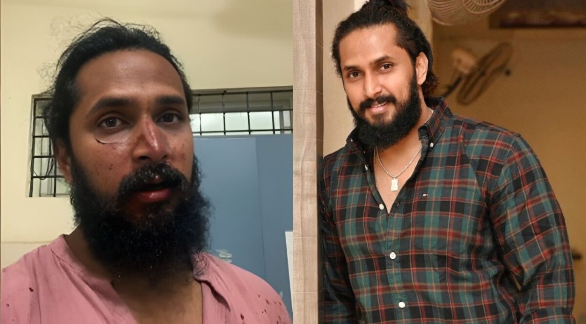 मां संग मंदिर गए थे एक्टर, रास्ते में 20 गुंडों ने मार-मार कर मुंह फोड़ दिया, नाक की हड्डी टूटी CrimeTak