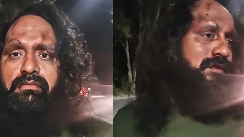 "खालिस्तानी !....तुम्हें 1984 याद दिला देंगे", अस्पताल में पड़े सिख नौजवान ने बताया उस रात का सच "खालिस्तानी !....तुम्हें 1984 याद दिला देंगे", अस्पताल में पड़े सिख नौजवान ने बताया उस रात का सच