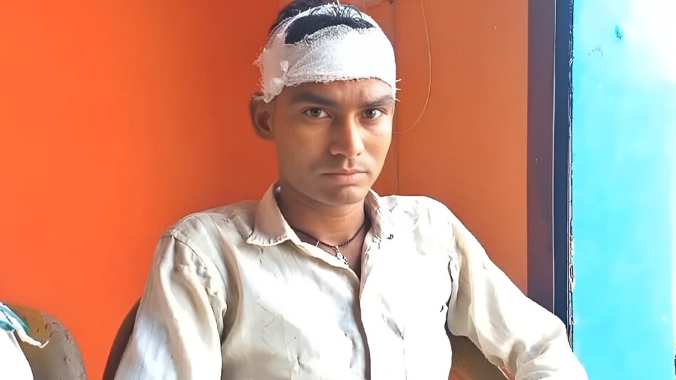 बीवी की Call नहीं उठाई तो घर पहुँचते ही ईंट मारकर पति का सिर फोड़ डाला, अब इसलिए दौड़ रही है Police बीवी की Call नहीं उठाई तो घर पहुँचते ही ईंट मारकर पति का सिर फोड़ डाला, अब इसलिए दौड़ रही है Police