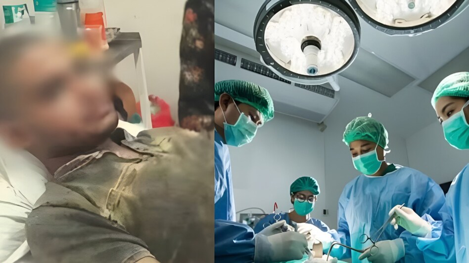 धोखे से प्राइवेट पार्ट कटवा कर दोस्त ने लड़के से बनाया लड़की, पुलिस ने पकड़ा तो बोला लड़की बना शादी करना चाहता है धोखे से प्राइवेट पार्ट कटवा कर दोस्त ने लड़के से बनाया लड़की, पुलिस ने पकड़ा तो बोला लड़की बना शादी करना चाहता है