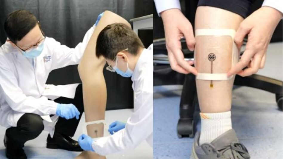 Photo: Smart Bandage, NUS Photo: Smart Bandage, NUS