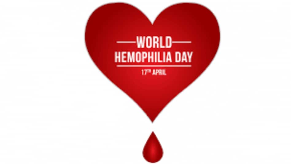 World Hemophilia Day 2022: जानलेवा हो सकता है हीमोफिलिया, जानें इसका कारण, लक्षण और प्रकार - World Hemophilia Day 2022 know the reason symptoms types and is it common in women - GNT