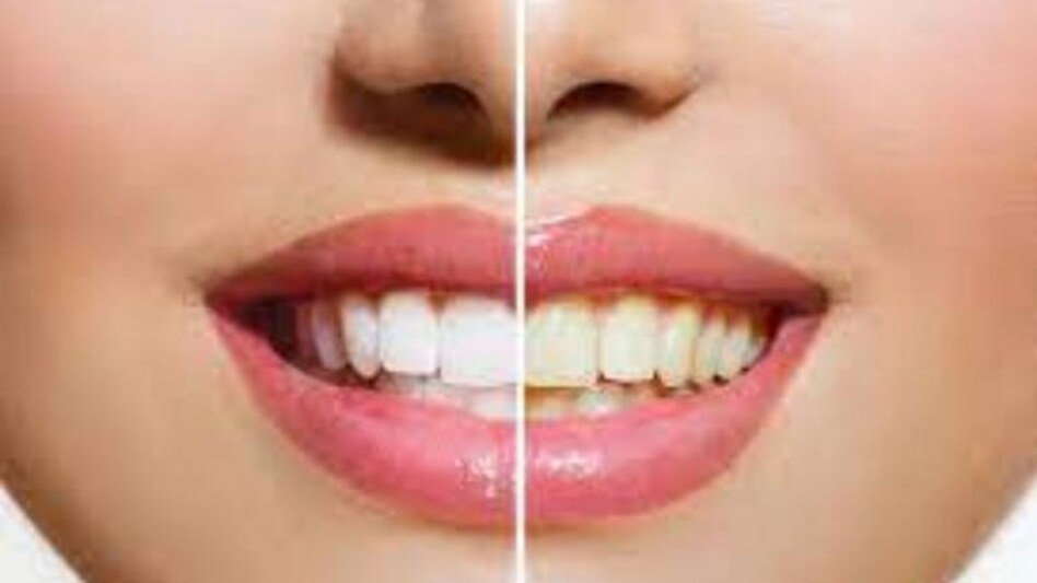 keep teeth away from yellowing keep teeth away from yellowing