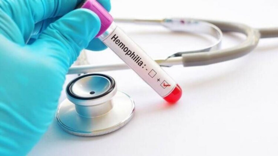 hemophilia treatment hemophilia treatment