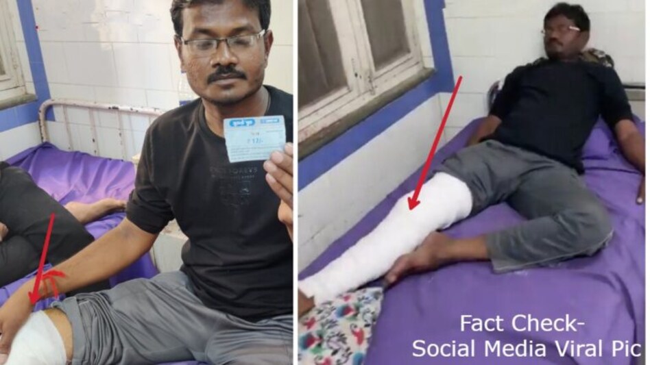 PM મોદીના આગમન પહેલા હોસ્પિટલને જ નહીં દર્દીઓને પણ નવું પ્લાસ્ટર લગાવાયું? જાણો શું છે સત્ય.. gujarattak