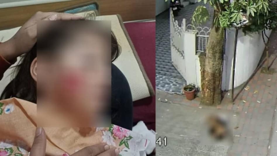 શેરીમાં રમતી બાળકી પર કૂતરાએ હૂમલો કર્યો, બચાવવા આવેલા મહિલાને પણ ભર્યું બચકું gujarattak