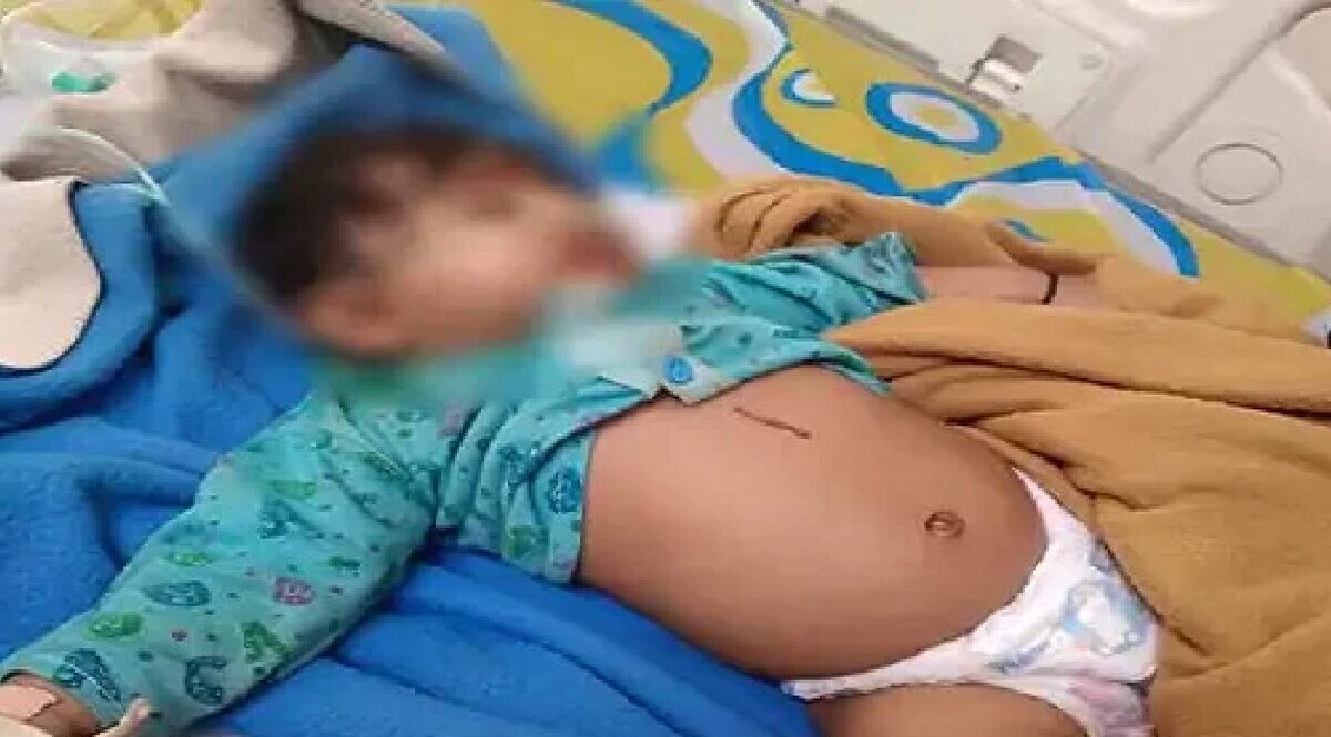 21મી સદીમાં પણ અંધશ્રદ્ધાનું અસ્તિત્વ, પોરબંદરમાં 2 માસની બાળકીને ભુવાએ દીધો ડામ gujarattak