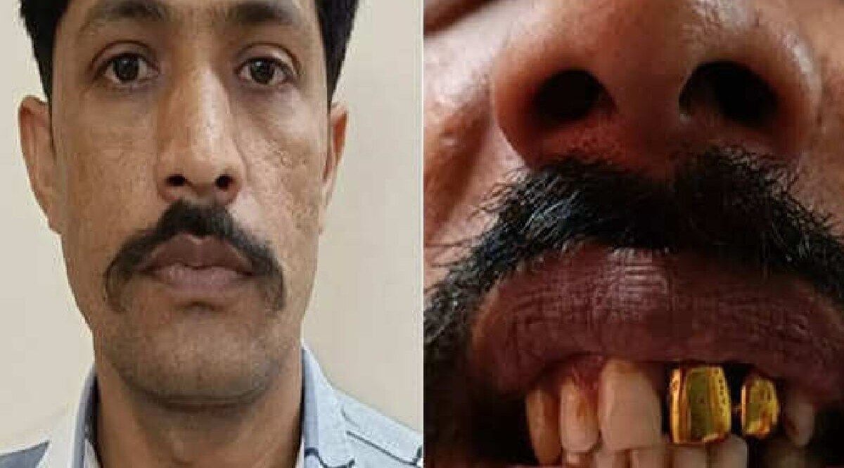 સોનાના દાંતથી ઓળખાયો આરોપી, મુંબઈ પોલીસે 15 વર્ષથી ફરાર ભાગેડુને પકડી પાડ્યો gujarattak