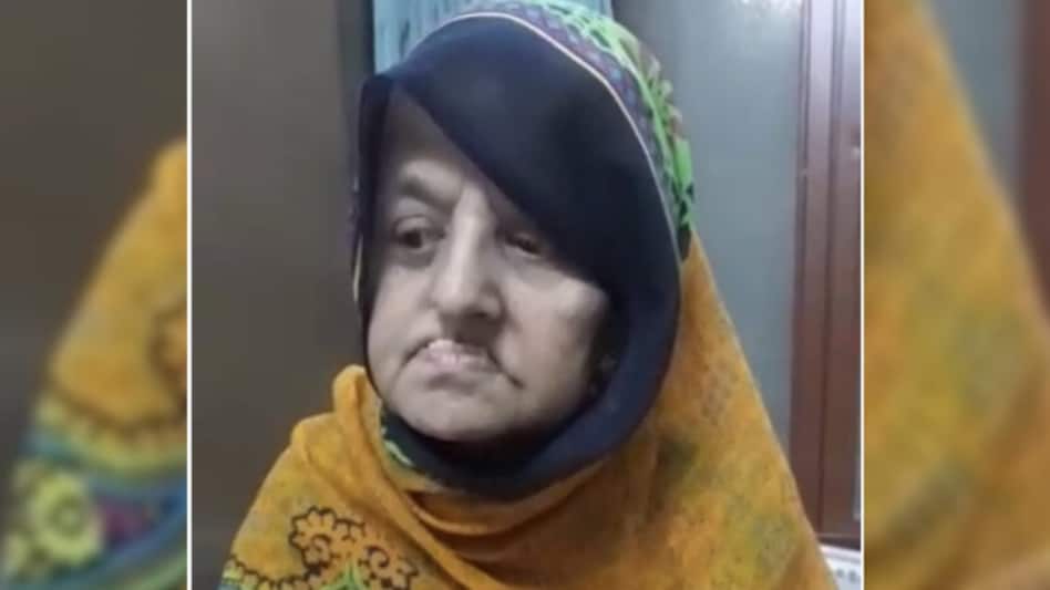 પાકિસ્તાની તબીબે કહ્યું ‘સાજા નહીં થાઓ’ તે મહિલાનો સુરતના ડોકટરે ઈલાજ કર્યો gujarattak