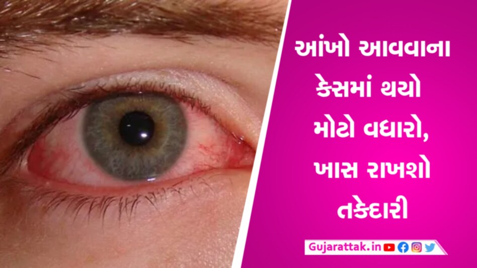 અમદાવાદમાં ખુટી પડ્યા Eye-Drops, કંજક્ટીવાઈટીસના કેસ વધતા સરકાર પાસે વધુ 50,000ની માગણી gujarattak