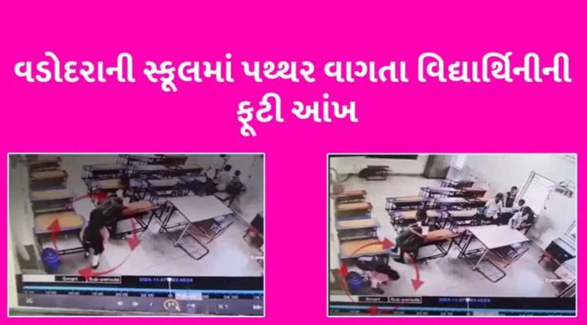 Vadodara: સ્કૂલનો સમય પૂરો થતાં ઘરે જવા ઉભી થઈ બાળકી, ક્લાસરૂમની બારીમાંથી આવેલો પથ્થર વાગતા ફૂટી આંખ gujarattak