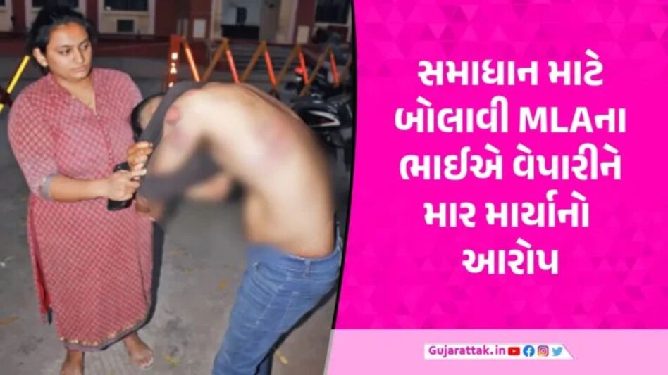 Vadodara News: MLAના ભાઈની દાદાગીરી, સોની વેપારીને સમાધાન માટે બોલાવી ઢોર માર માર્યો gujarattak