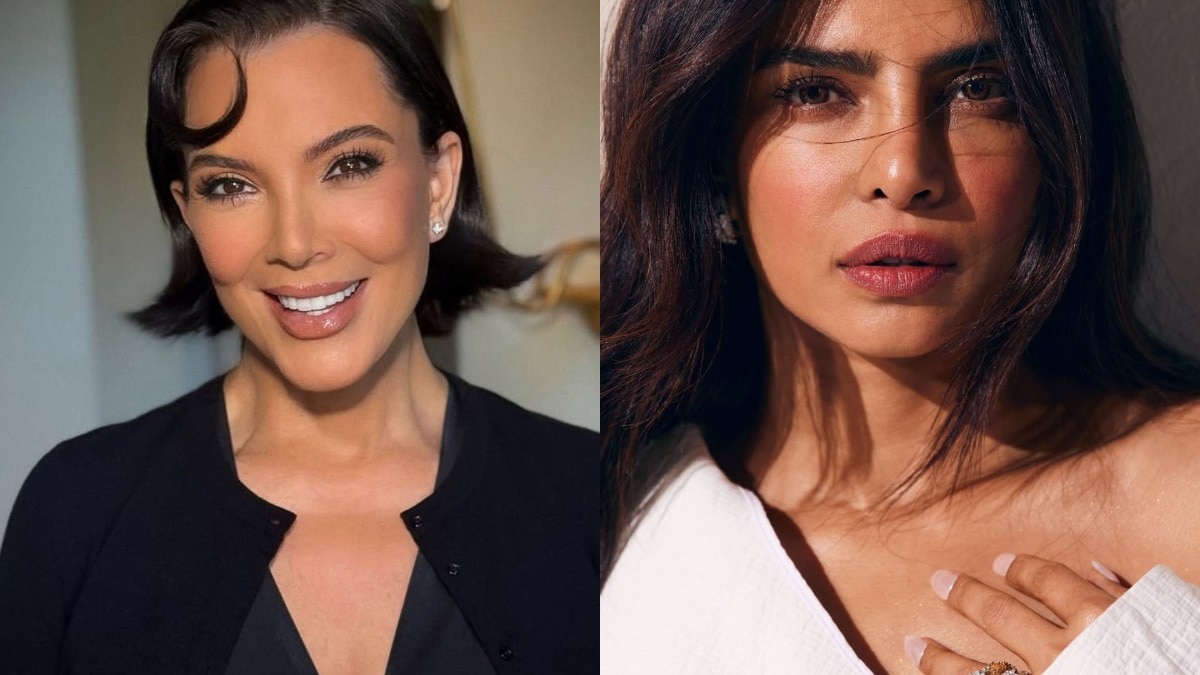 15+ celebrities who opened up about undergoing cosmetic surgery