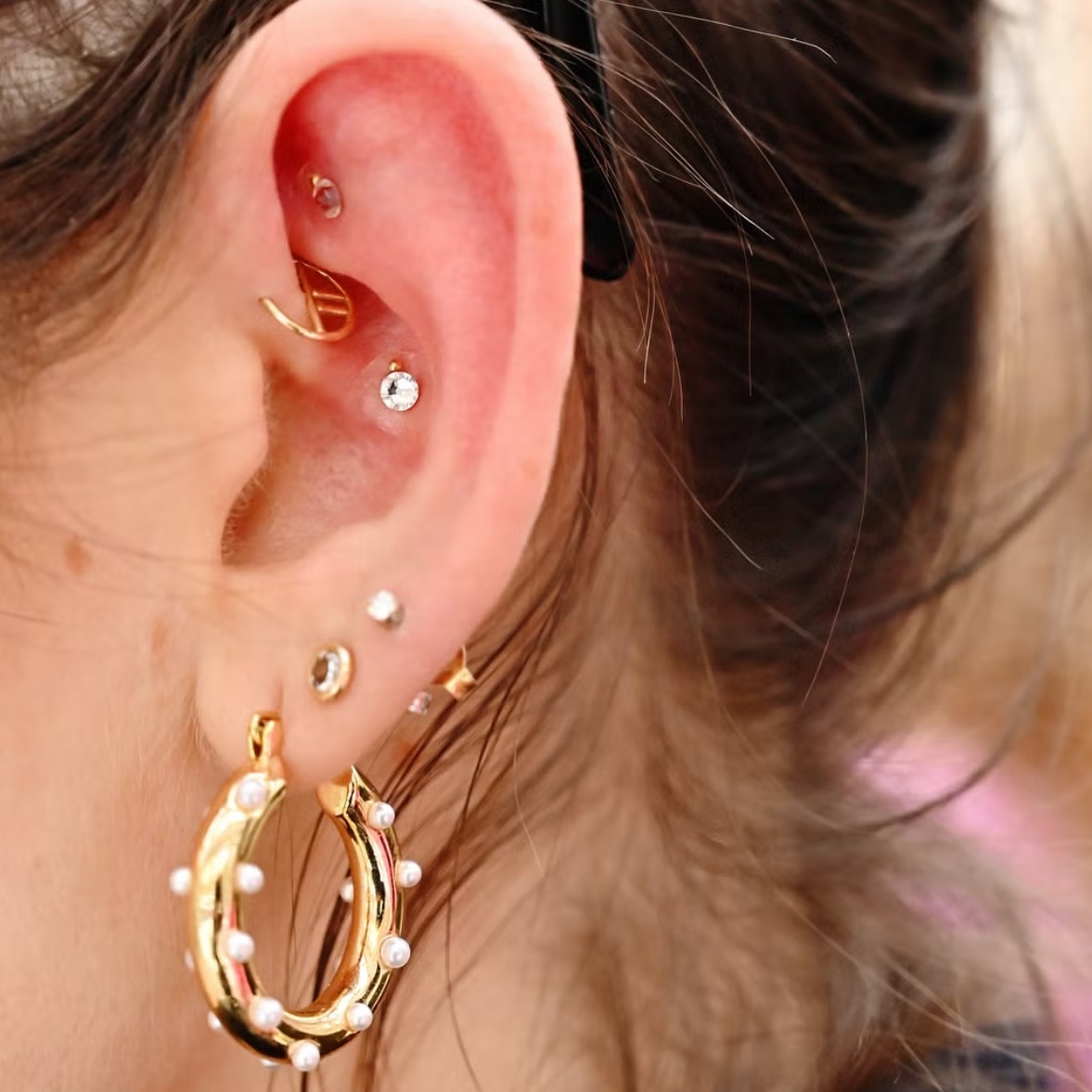Ear seeding is everywhere, but does it really help with anxiety?