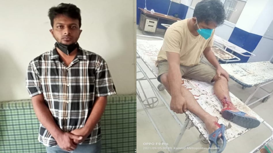 Assam Police shot prime accused Bishal Choudhury Assam Police shot prime accused Bishal Choudhury