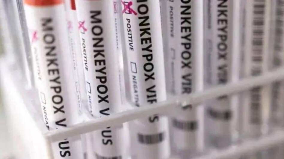 WHO declares monkeypox a global health emergency WHO declares monkeypox a global health emergency