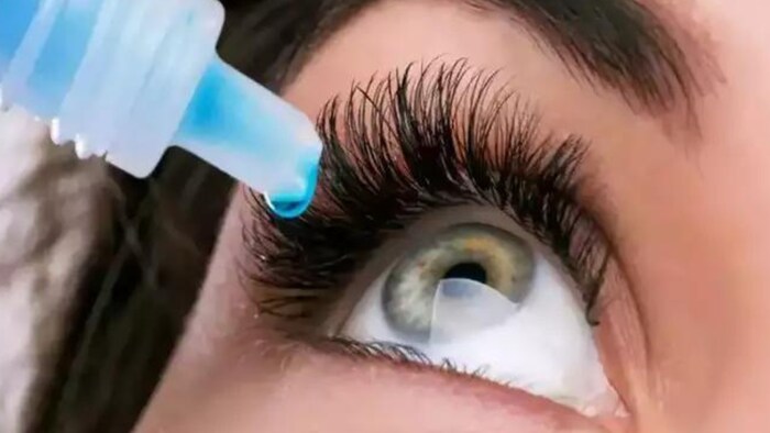 150 में 30 छात्राओं में आई फ्लू (कंजेक्टिवाइटिस) की चिकित्सकों ने पुष्टि की.