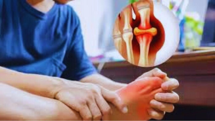 यूरिक एसिड क्या है और इससे होने वाली समस्याएं