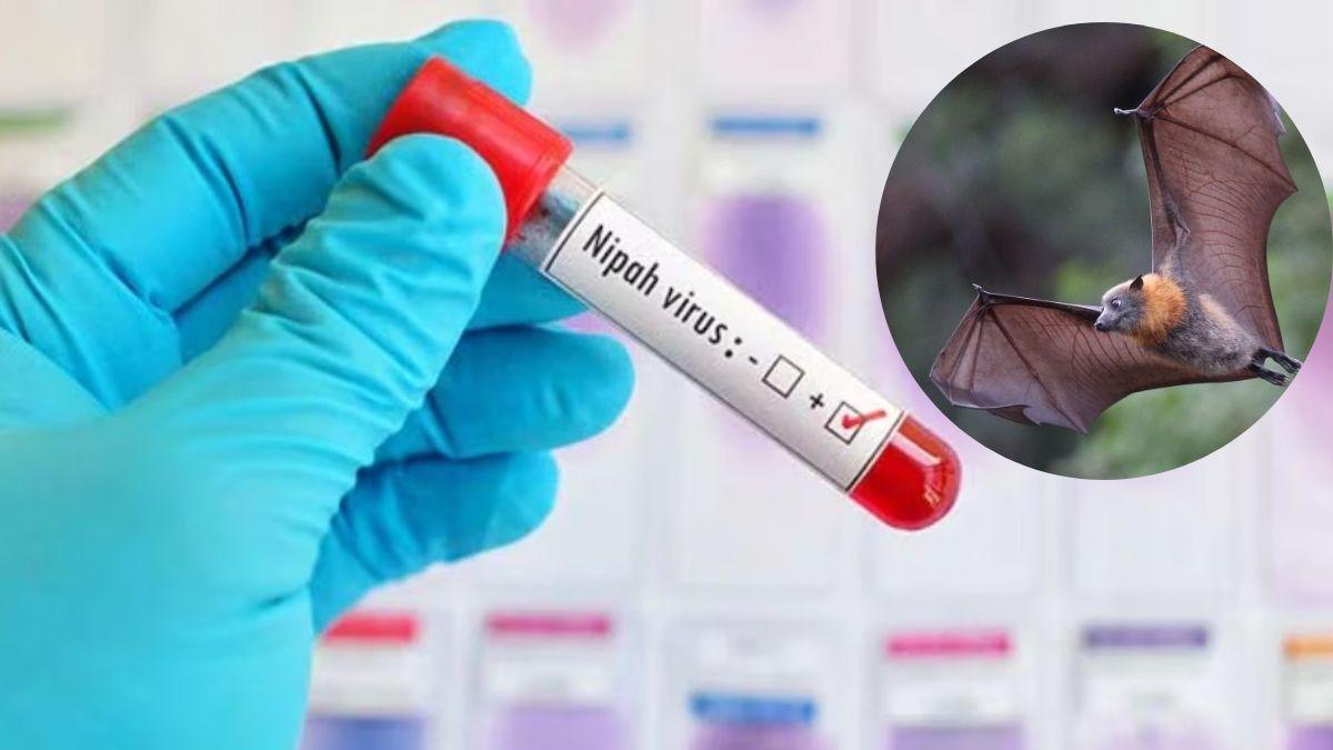 Nipah Virus: निपाह वायरस के ये हैं खतरनाक लक्षण, इसके रोकथाम का तरीका भी जान लीजिए