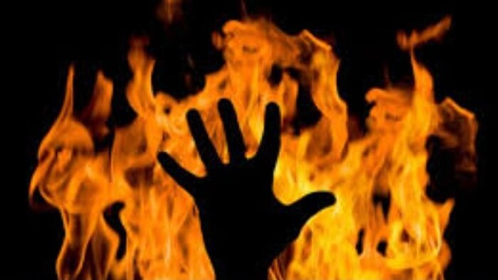 Farmer Burnt Himself