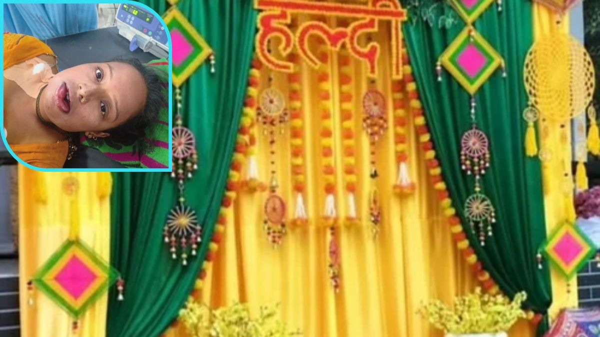 शादी की हल्दी बनी मुसीबत! दुल्हन पहुंची ICU, जानिए असली और नकली हल्दी की पहचान