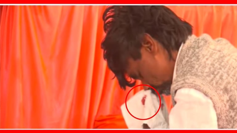 Manoj Jarange यांच्या नाकातून येतंय रक्त, लोकांच्या डोळ्यात अश्रू अनावर Manoj Jarange Patil's Health condition worsened.