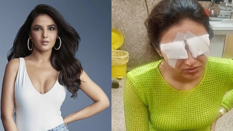 Jasmin Bhasin : ''डेंजर झोन....'',  डोळ्यांना दुखापत झालेल्या जस्मिनने दिली मोठी हेल्थ अपडेट!  जस्मिनची हेल्थ अपडेट समोर आली आहे.