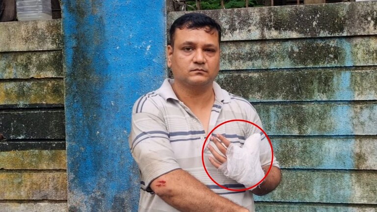 Mumbai Crime: 'धक्का मारला, छातीवर बसला अन् अंगठाच चाऊन फाडला'; सोसायटी मीटिंगमध्ये भयानक थरार! Mumbai Tak