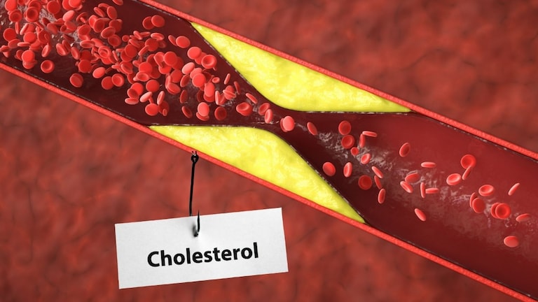 Cholesterol : कोलेस्ट्रॉल करु शकतं  तुमचा घात, 'हे' खाद्यपदार्थ खाणं आजच थांबवा! Mumbai Tak