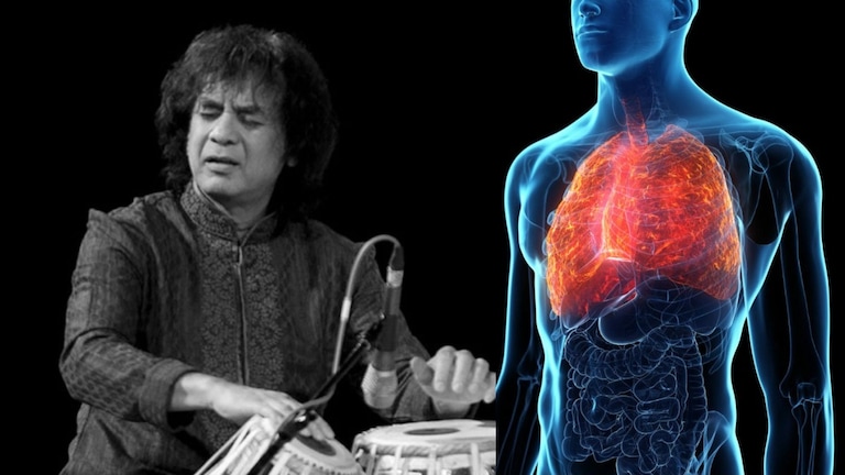 Zakir Hussain यांचा ज्यामुळे मृत्यू झाला, तो IPF आजार नेमका काय? काय आहेत लक्षणं आणि उपचार? Mumbai Tak