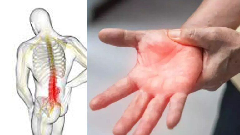 GBS Disease : राज्यात GBS मुळे पहिला मृत्यू? रुग्णांची संख्याही वाढली, धोका वाढला... Mumbai Tak