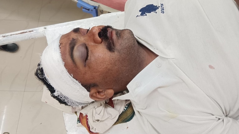 बीडमध्ये हे चाललंय तरी काय? वाल्मिक कराडच्या बातम्या पाहणाऱ्या तरुणाला तुफान मारहाण वाल्मिक कराडच्या बातम्या पाहणाऱ्या तरुणाला तुफान मारहाण