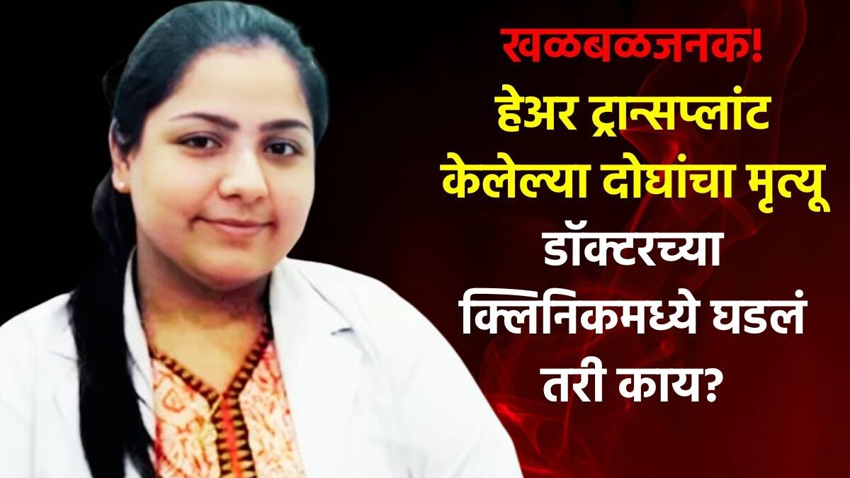 बापरे... हेअर ट्रान्सप्लांट केला अन् दोघांचा जीव गेला, डॉ. अनुष्काने असं केलं तरी काय? BDS Doctor Viral News