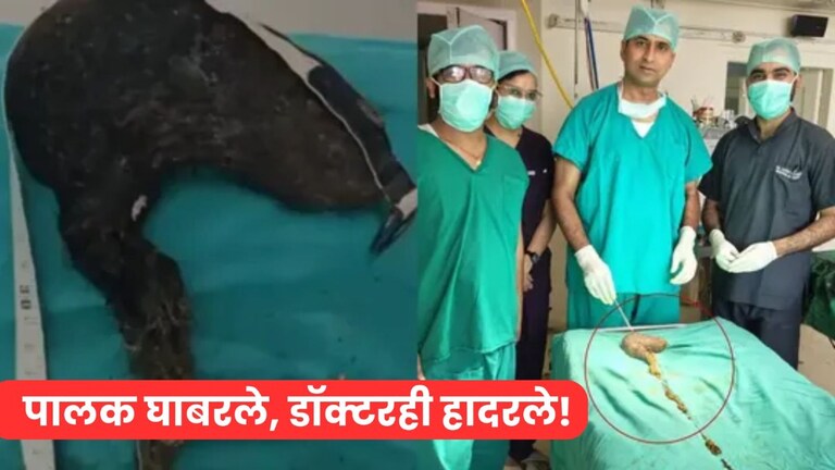 पोट दुखतं म्हणून तपासणी केली, 10 वीच्या मुलीच्या पोटात आढळली 210 सेंटीमिटरची... Mumbai Tak