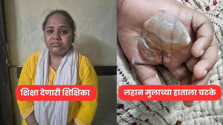 शिक्षिका म्हणायचं की... 8 वर्षाच्या मुलाचे तळहात पाहून तुमचाही होईल संताप, चक्क मेणबत्तीने.. Mumbai Crime