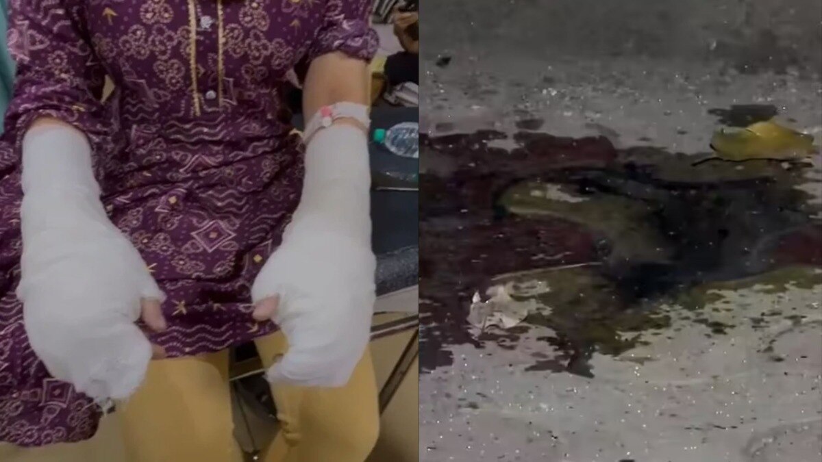 Delhi crime acid attack