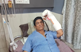 नारळपाणी विकणाऱ्या सलीमने छाटली डोंबिलीच्या दयानंदची बोटं, करंगळी तर तुटलीच अन्... dombivli minor dispute over coconut sale turns bloody hawker stabs resident in hand breaks little finger