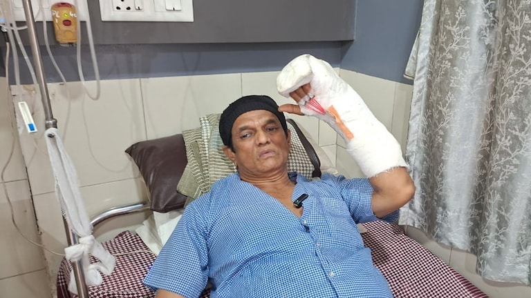 नारळपाणी विकणाऱ्या सलीमने छाटली डोंबिवलीच्या दयानंदची बोटं, करंगळी तर तुटलीच अन्... dombivli minor dispute over coconut sale turns bloody hawker stabs resident in hand breaks little finger