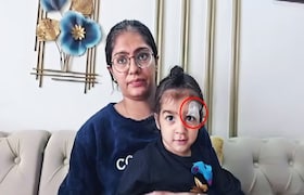 जखमेवर टाके घालण्याऐजवी डॉक्टरांनी फेवीक्विक लावलं! अडीच वर्षांच्या चिमुकल्यासोबत धक्कादायक प्रकार... जखमेवर टाके घालण्याऐजवी फेवीक्विक लावलं!