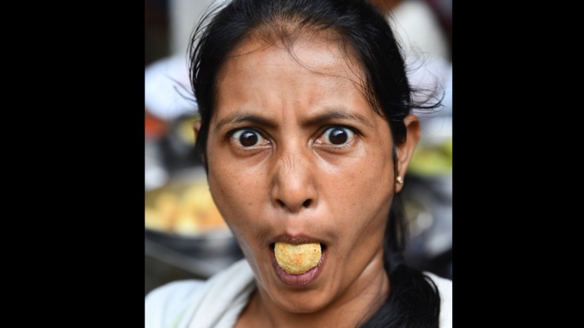 पाणीपुरी खाताना महिलेचं तोंड उघडचं राहिलं, नंतर जबडा देखील बंद होईना, डॉक्टरही चक्रावले... viral news