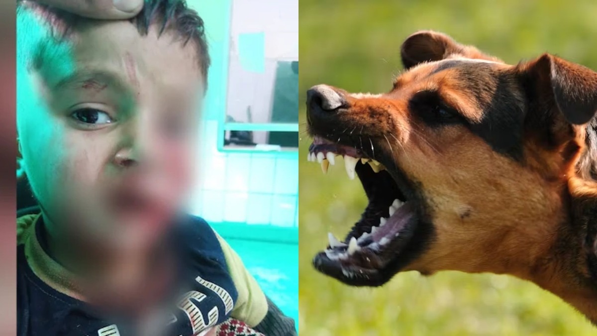 dog ​​attacked a four-year-old child
