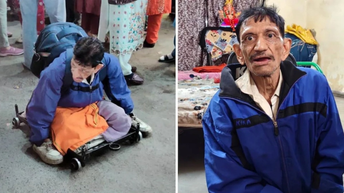 'भिकारी' म्हणून प्रशासनाने फोटो व्हायरल केले, पण 'त्या' कुष्ठरोग असलेल्या वृद्धाचे नातेवाईक कोट्याधीश