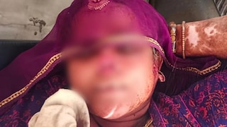 जावयाला लागली 'त्या' गोष्टीची कुणकुण, सासूचे कात्रीने नाक कापले अन् नथ घेऊन पळाला; धक्कादायक प्रकरण Mumbai Tak