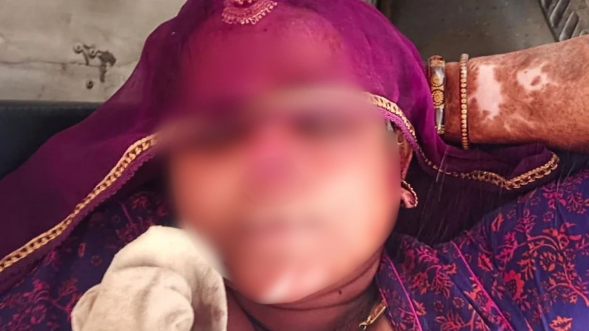 जावयाला लागली 'त्या' गोष्टीची कुणकुण, सासूचे कात्रीने नाक कापले अन् नथ घेऊन पळाला; धक्कादायक प्रकरण